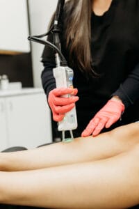 laser hair removal