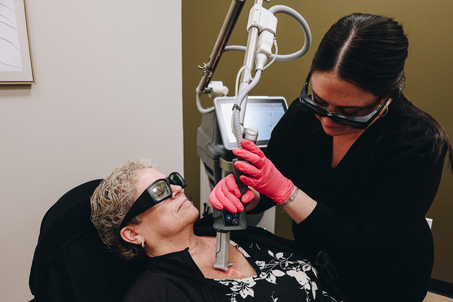 Laser Resurfacing
