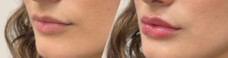 Lips