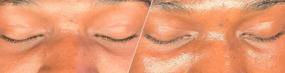 Dry & Dull Skin